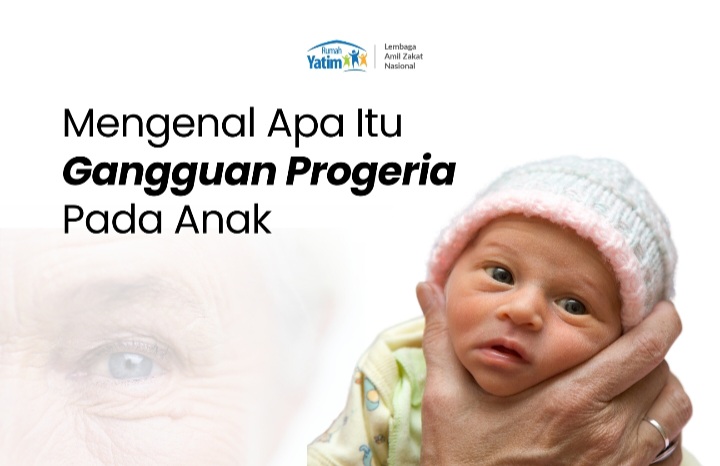 image-news